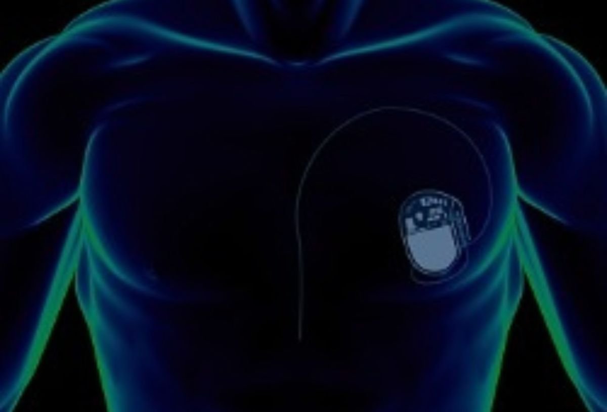 Medical Device Approval Primer  | CPE – CPE LATEST